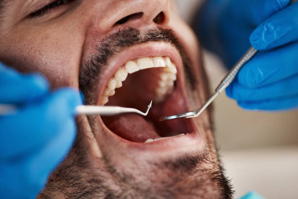Best Emergency Dental Care for Sports Injuries in Mondovi, WI